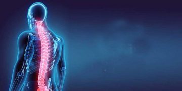 How Physical Therapy Can Cure Back Pain and Lateral Shift