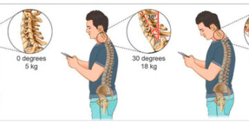 “Text Neck Syndrome: How Smartphones Are Damaging Your Spine (And How to Fix It)”